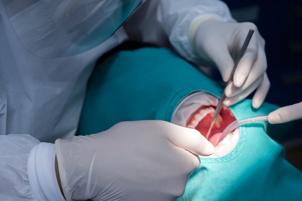 Enhanced Comfort Through Sedation Oral Surgery